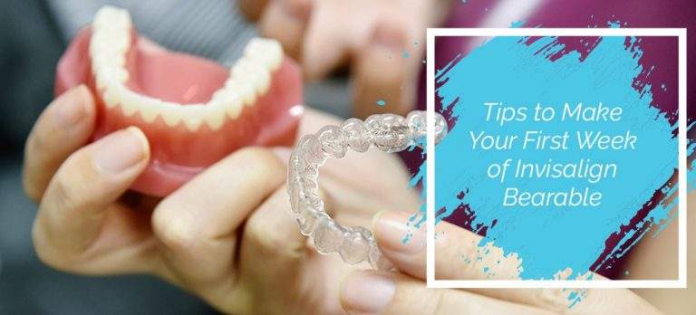 Tips to Make Your First Week Of Invisalign Bearable