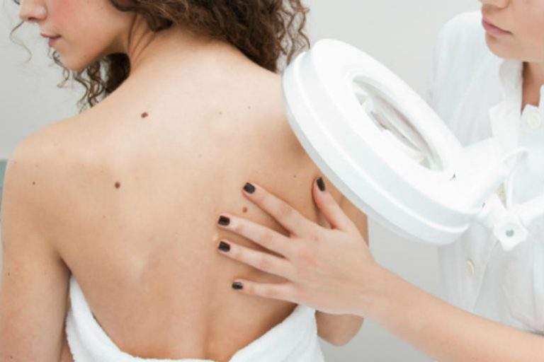 Birthmark Removal Surgery Can Be Safe, Effective, and Inexpensive