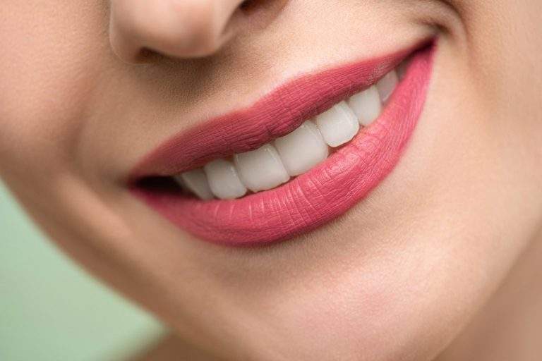 6 Must-Haves For A Beautiful Smile